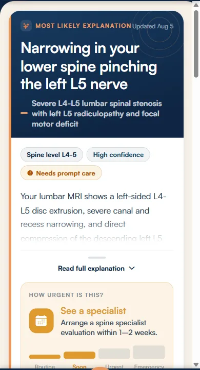 SpineSense result screen: the most likely explanation in plain language, with a confidence level and guidance on how soon to be seen